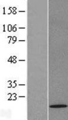 Western Blot: TOMM22 Overexpression Lysate (Adult Normal) [NBL1-17190] Left-Empty vector transfected control cell lysate (HEK293 cell lysate); Right -Over-expression Lysate for TOMM22.