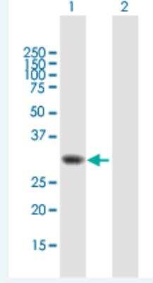 Western Blot: TOMM34 Antibody [H00010953-B01P-50ug] - Analysis of TOMM34 expression in transfected 293T cell line (H00010953-T01) by TOMM34 MaxPab polyclonal antibody.  Lane 1: TOMM34 transfected lysate(33.99 KDa). Lane 2: Non-transfected lysate.