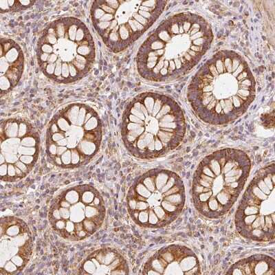 Immunohistochemistry: TOMM40 Antibody [NBP2-37879] - Staining of human rectum shows strong cytoplasmic positivity in glandular cells.