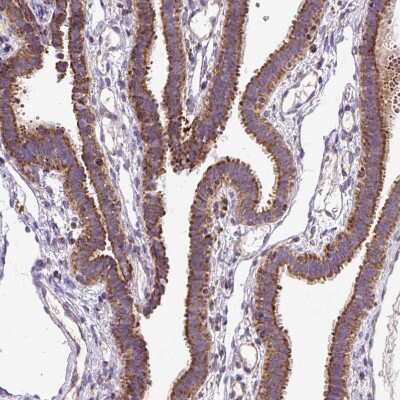 Immunohistochemistry-Paraffin: TOMM40 Antibody [NBP2-38289] - Staining of human Fallopian tube shows moderate granular positivity in cytoplasm in glandular cells.