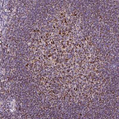 Immunohistochemistry-Paraffin: TOMM40 Antibody [NBP2-38289] - Staining of human tonsil shows strong granular positivity in cytoplasm in germinal center cells.