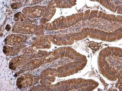 Immunohistochemistry-Paraffin: TOMM40 Antibody [NBP3-13293] - TOMM40 antibody detects TOMM40 protein at mitochondria by immunohistochemical analysis. Sample: Paraffin-embedded mouse duodenum. TOMM40 stained by TOMM40 antibody (NBP3-13293) diluted at 1:2000. Antigen Retrieval: Citrate buffer, pH 6.0, 15 min