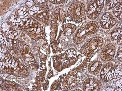 Immunohistochemistry-Paraffin: TOMM40 Antibody [NBP3-13293] - TOMM40 antibody detects TOMM40 protein at mitochondria by immunohistochemical analysis. Sample: Paraffin-embedded rat colon. TOMM40 stained by TOMM40 antibody (NBP3-13293) diluted at 1:2000. Antigen Retrieval: Citrate buffer, pH 6.0, 15 min