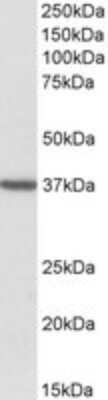 Western Blot: TOMM40 Antibody [NBP1-51997] - Analysis of TOMM40 in Human Frontal Cortex lysate (35ug protein in RIPA buffer) using NBP1-51997 at 2ug/ml. Primary incubation was 1 hour. Detected by chemiluminescence.