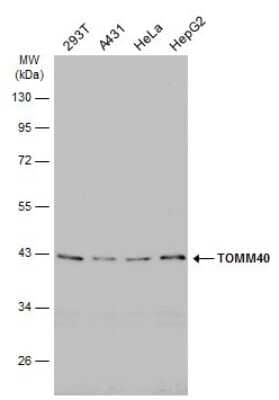 Western Blot: TOMM40 Antibody [NBP3-13290] - Various whole cell extracts (30 ug) were separated by 10% SDS-PAGE, and the membrane was blotted with TOMM40 antibody (NBP3-13290) diluted at 1:500. The HRP-conjugated anti-rabbit IgG antibody (NBP2-19301) was used to detect the primary antibody.