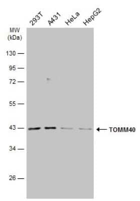 Western Blot: TOMM40 Antibody [NBP3-13293] - Various whole cell extracts (30 ug) were separated by 10% SDS-PAGE, and the membrane was blotted with TOMM40 antibody (NBP3-13293) diluted at 1:1000. The HRP-conjugated anti-rabbit IgG antibody (NBP2-19301) was used to detect the primary antibody.