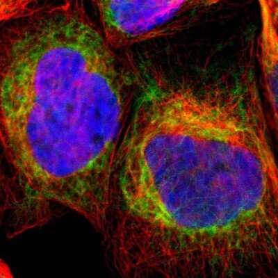 Immunocytochemistry/ Immunofluorescence TOMM6 Antibody - BSA Free