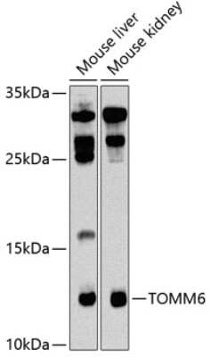 Western Blot: TOMM6 Antibody [NBP2-93442] - Analysis of extracts of various cell lines, using TOMM6 at 1:1000 dilution. Secondary antibody: HRP Goat Anti-Rabbit IgG (H+L) at 1:10000 dilution. Lysates/proteins: 25ug per lane. Blocking buffer: 3% nonfat dry milk in TBST. Detection: ECL Basic Kit . Exposure time: 90s.
