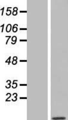 Western Blot: TOMM7 Overexpression Lysate (Adult Normal) [NBL1-17193] Left-Empty vector transfected control cell lysate (HEK293 cell lysate); Right -Over-expression Lysate for TOMM7.