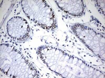 Immunohistochemistry: TOP2A Antibody (OTI2A9) - Azide and BSA Free [NBP2-74558] - Analysis of Human colon tissue. (Heat-induced epitope retrieval by 10mM citric buffer, pH6.0, 120C for 3min)