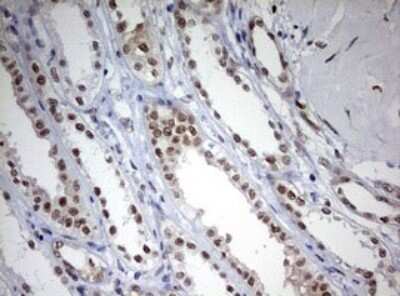 Immunohistochemistry: TOP2A Antibody (OTI2A9) - Azide and BSA Free [NBP2-74558] - Analysis of Human Kidney tissue. (Heat-induced epitope retrieval by 10mM citric buffer, pH6.0, 120C for 3min)