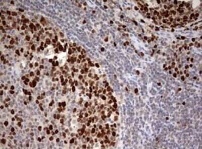 Immunohistochemistry: TOP2A Antibody (OTI2A9) - Azide and BSA Free [NBP2-74558] - Analysis of Human lymph node tissue. (Heat-induced epitope retrieval by 10mM citric buffer, pH6.0, 120C for 3min)