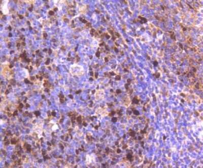 Immunohistochemistry-Paraffin: TOP2A Antibody (SY27-00) [NBP2-67442] - Analysis of paraffin-embedded human tonsil tissue using anti-Topoisomerase II alpha antibody. Counter stained with hematoxylin.