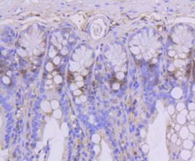 Immunohistochemistry-Paraffin: TOP2A Antibody (SY27-00) [NBP2-67442] - Analysis of paraffin-embedded mouse colon tissue using anti-Topoisomerase II alpha antibody. Counter stained with hematoxylin.