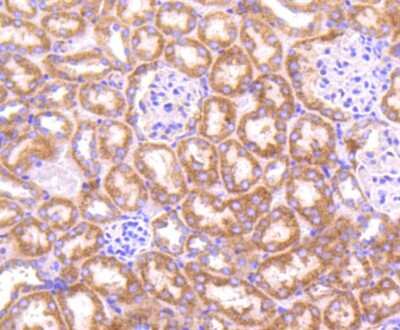 Immunohistochemistry-Paraffin: TOP2A Antibody (SY27-00) [NBP2-67442] - Analysis of paraffin-embedded mouse kidney tissue using anti-Topoisomerase II alpha antibody. Counter stained with hematoxylin.