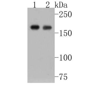 Western Blot: TOP2A Antibody (SY27-00) [NBP2-67442] - Analysis of Topoisomerase II alpha on different lysates. Proteins were transferred to a PVDF membrane and blocked with 5% BSA in PBS for 1 hour at room temperature. The primary antibody (1/500) was used in 5% BSA at room temperature for 2 hours. Goat Anti-Rabbit IgG - HRP Secondary Antibody at 1:5,000 dilution was used for 1 hour at room temperature. Positive control:Lane 1: mouse testis tissue lysate Lane 2: MCF-7 cell lysate