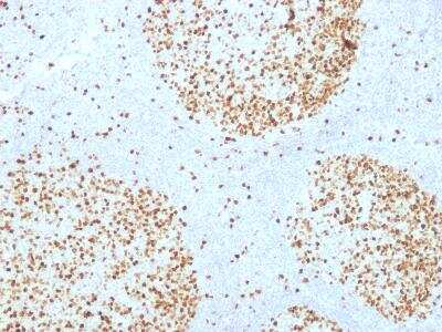 Immunohistochemistry-Paraffin: TOP2A Antibody (TOP2A/1361) [NBP2-47643] - Formalin-fixed, paraffin-embedded Human Tonsil stained with Topoisomerase II alpha Monoclonal Antibody (TOP2A/1361).  