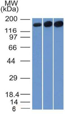 Western Blot: TOP2A Antibody (TOP2A/1361) [NBP2-47643] - HepG2, HeLa and 3T3 Cell Lysate using Topo II alpha, Monoclonal Antibody (TOP2A/1361).