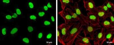 Immunocytochemistry/Immunofluorescence: TOP2B Antibody [NBP2-20684] -  HeLa cells were fixed in 4% paraformaldehyde at RT for 15 min. Green: Topoisomerase II beta stained by Topoisomerase II beta antibody [C3], C-term  diluted at 1:500. Red: phalloidin, a cytoskeleton marker, diluted at 1:100.Scale bar= 10 um. 