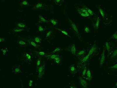 Immunocytochemistry/Immunofluorescence: TOP2B Antibody [NBP2-97789] - Immunofluorescence staining of TOP2B in U251MG cells. Cells were fixed with 4% PFA, permeabilzed with 0.1% Triton X-100 in PBS, blocked with 10% serum, and incubated with rabbit anti-Human TOP2B polyclonal antibody (dilution ratio 1:200) at 4C overnight. Then cells were stained with the Alexa Fluor(R)488-conjugated Goat Anti-rabbit IgG secondary antibody (green). Positive staining was localized to Nucleus and cytoplasm.