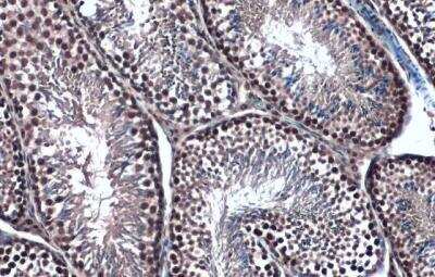 Immunohistochemistry-Paraffin: TOP2B Antibody [NBP2-20684] - Mouse testis. Topoisomerase II beta stained by Topoisomerase II beta antibody [C3], C-term diluted at 1:500. Antigen Retrieval: Citrate buffer, pH 6.0, 15 min. 