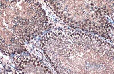 Immunohistochemistry-Paraffin: TOP2B Antibody [NBP2-20684] - Mouse brain. Topoisomerase II beta stained by Topoisomerase II beta antibody [C3], C-term diluted at 1:500. Antigen Retrieval: Citrate buffer, pH 6.0, 15 min.