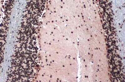 Immunohistochemistry-Paraffin: TOP2B Antibody [NBP2-20684] - Mouse brain. Topoisomerase II beta stained by Topoisomerase II beta antibody [C3], C-term diluted at 1:500. Antigen Retrieval: Citrate buffer, pH 6.0, 15 min.