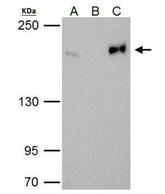 Immunoprecipitation: TOP2B Antibody [NBP2-20684] - HeLa whole cell lysate/extract A. 40 ug HeLa whole cell lysate/extract B. Control with 2 ug of preimmune rabbit IgG C. Immunoprecipitation of Topoisomerase II beta protein by 2 ug of Topoisomerase II beta antibody 5% SDS-PAGE The immunoprecipitated Topoisomerase II beta protein was detected by Topoisomerase II beta antibody diluted at 1:1000. EasyBlot anti-rabbit IgG was used as a secondary reagent.