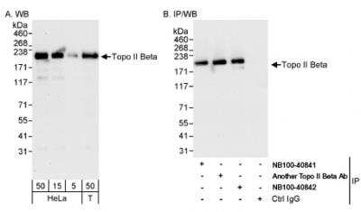 <b>Independent Antibodies Validation and Biological Strategies Validation.</b>Western Blot: TOP2B Antibody [NB100-40842] - Detection of Human Topo II Beta on HeLa whole cell lysate using NB100-40842. Topo II Beta was also immunoprecipitated by another rabbit anti-Topo II Beta antibody and NB100-40841.