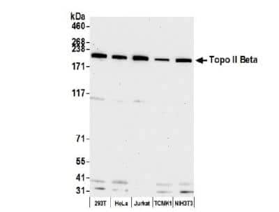 Western Blot: TOP2B Antibody [NB100-40842] - Whole cell lysate (50 ug) from HEK293T, HeLa, Jurkat, TCMK-1, and NIH 3T3 cells prepared using NETN lysis buffer. Antibody: Affinity purified rabbit anti-Topo II Beta antibody used for WB at 0.04 ug/ml. Detection: Chemiluminescence withan exposure time of 30 seconds