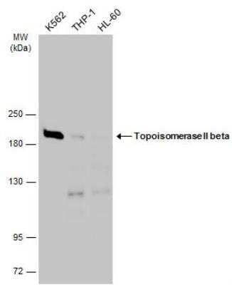 Western Blot: TOP2B Antibody [NBP2-20684] - Various whole cell extracts (30 ug) were separated by 5% SDS-PAGE, and the membrane was blotted with Topoisomerase II beta antibody [C3], C-term diluted at 1:3000. The HRP-conjugated anti-rabbit IgG antibody (NBP2-19301) was used to detect the primary antibody.