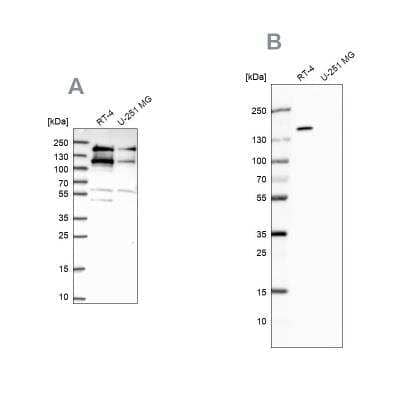 Western Blot: TOP2B Antibody [NBP2-58728] - Analysis using Anti-TOP2B antibody NBP2-58728 (A) shows similar pattern to independent antibody NBP1-89527 (B).