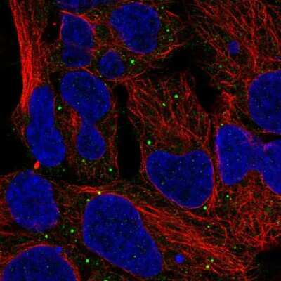 Immunocytochemistry/Immunofluorescence: TOR/mTOR Antibody [NBP2-55920] - Staining of human cell line HEK 293 shows localization to vesicles.