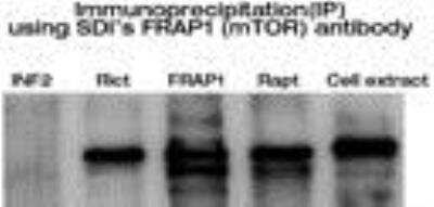 Immunoprecipitation: TOR/mTOR Antibody [28130002] - Several commercially available antibodies which were generated using short peptides failed to isolate the FRAP1 protein complexes. SDI's FRAP1(TOR/mTOR) antibody, 2813.00.02, was generated using in vivo expressed immunogen of 100 amino acids. It was used to pull down protein complexes through immunoprecipitation. It demonstrated that Rictor and Raptor formed the distinct complexes with FRAP (mTOR). The immunoprecipitation conditions were described in Sarbassov et al (Phosphorylation and regulation of Akt/PKB by the Rictor-mTOR complex, Science 307:1098-1101, 2005, supporting online material, material and methods). FRAP1 was detected in Western blot using FRAP1 antibody at 1:4000 dilution. The experiments were performed using MDA MB-435 human cancer cell line and NF2 was used as control.