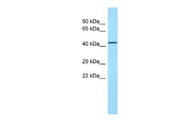 Western Blot: TOR1AIP2 Antibody [NBP2-85971] - WB Suggested Anti-TOR1AIP2 Antibody. Titration: 1.0 ug/ml. Positive Control: Fetal Lung