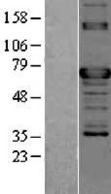 Western Blot: TOR1AIP2 Overexpression Lysate (Adult Normal) [NBL1-17197] Left-Empty vector transfected control cell lysate (HEK293 cell lysate); Right -Over-expression Lysate for TOR1AIP2.