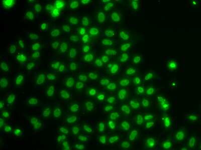 Immunocytochemistry/Immunofluorescence: TOX Antibody [NBP3-04932] - Analysis of U2OS cells using TOx antibody .