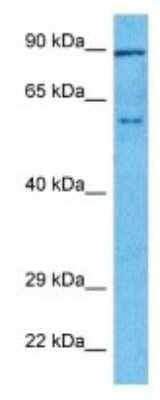 Western Blot: TOX Antibody [NBP3-10305] - Western blot analysis of TOX in Ovary Tumor lysates. Antibody dilution at 1.0ug/ml