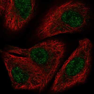 Immunocytochemistry/Immunofluorescence: TOX2 Antibody [NBP2-58503] - Staining of human cell line A549 shows localization to nucleoplasm.
