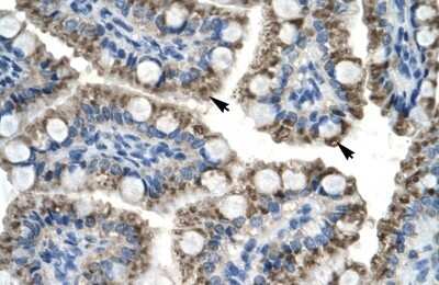 Immunohistochemistry-Paraffin: TOX2 Antibody [NBP1-79964] - Human Intestine Tissue, antibody concentration 4-8ug/ml. Cells with positive label: Epithelial cells of intestinal villus (indicated with arrows) 400X magnification.