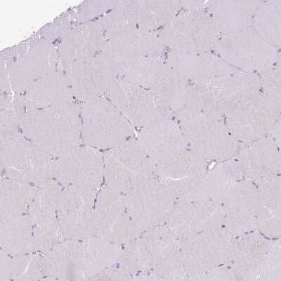 Immunohistochemistry-Paraffin: TOX2 Antibody [NBP2-13464] - Staining of human skeletal muscle shows no positivity in myocytes as expected.