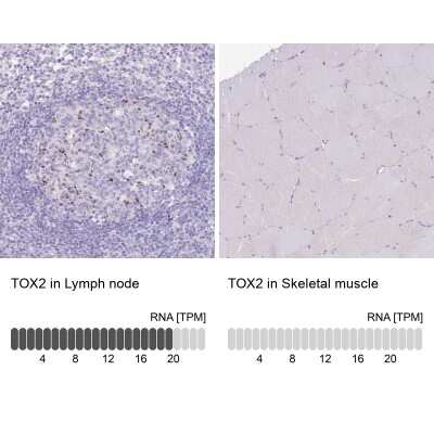 Immunohistochemistry-Paraffin: TOX2 Antibody [NBP2-13464] - Staining in human lymph node and skeletal muscle tissues.. Corresponding TOX2 RNA-seq data are presented for the same tissues.