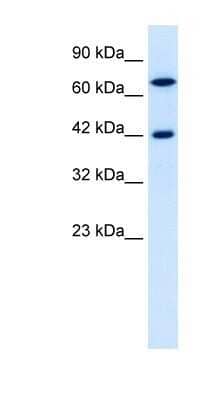 Western Blot TOX2 Antibody - BSA Free