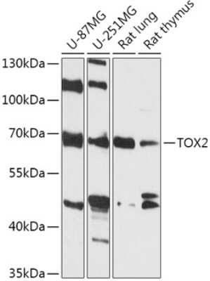 Western Blot: TOX2 Antibody [NBP2-94397] - Analysis of extracts of various cell lines, using TOX2 at 1:1000 dilution. Secondary antibody: HRP Goat Anti-Rabbit IgG (H+L) at 1:10000 dilution. Lysates/proteins: 25ug per lane. Blocking buffer: 3% nonfat dry milk in TBST. Detection: ECL Basic Kit . Exposure time: 90s.