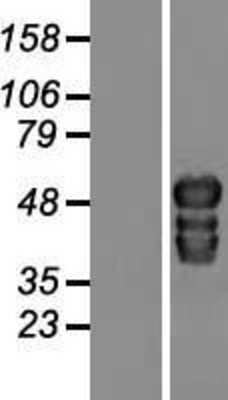 Western Blot: TOX2 Overexpression Lysate (Adult Normal) [NBP2-09307] Left-Empty vector transfected control cell lysate (HEK293 cell lysate); Right -Over-expression Lysate for TOX2.