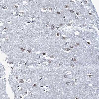 Immunohistochemistry-Paraffin: TOX3 Antibody [NBP1-86676] - Staining of human Cerebral cortex shows moderate nuclear positivity in neuronal cells.