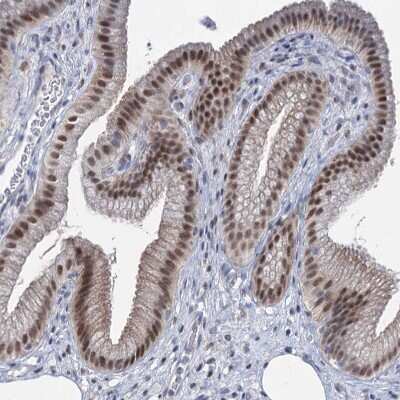 Immunohistochemistry-Paraffin: TOX3 Antibody [NBP1-86676] - Staining of human Gallbladder shows strong nuclear positivity in glandular cells.