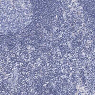Immunohistochemistry-Paraffin: TOX3 Antibody [NBP1-86676] - Staining of human Lymph node shows no positivity in non-germinal center cells as expected.