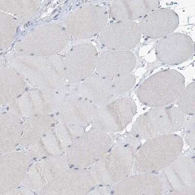 <b>Orthogonal Strategies Validation. </b>Immunohistochemistry-Paraffin: TOX3 Antibody [NBP1-86676] - Staining of human Skeletal muscle shows no positivity in myocytes as expected.