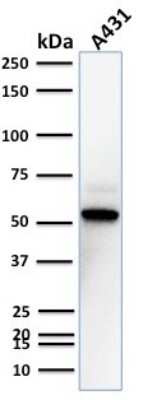 Western Blot: TOX3 Antibody (TOX3/1123) - Azide and BSA Free [NBP2-47748] - Western Blot Analysis of A431 cell lysate using TOX3 Mouse Monoclonal Antibody (TOX3/1123).
